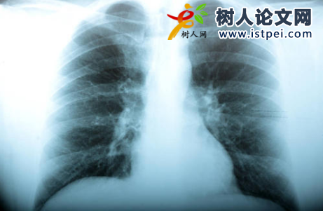 放射學(xué)論文參考文獻怎么查詢